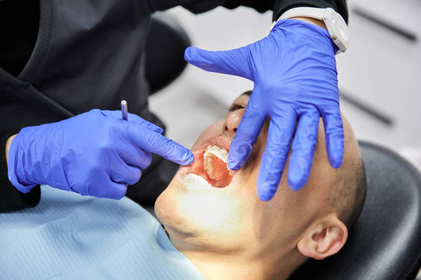 Best Emergency Broken Tooth Repair in Wheatland, WY