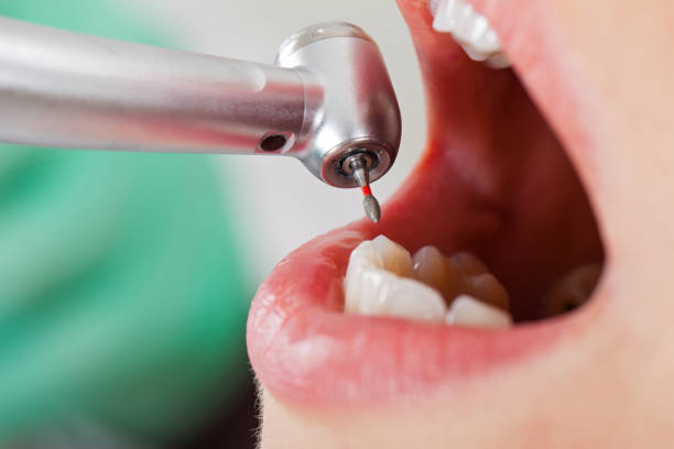 Best Walk-In Emergency Dentist in Wheatland, WY
